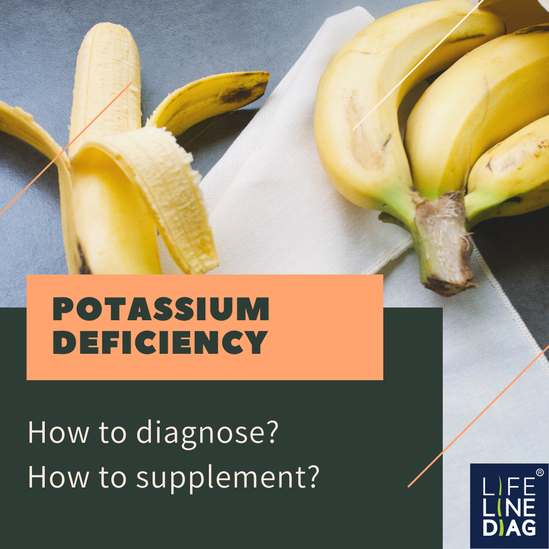 Potassium deficiency – how is it diagnosed? How can you supplement